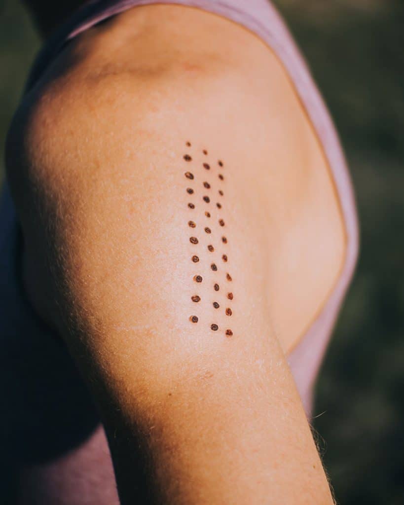 DoubleBlind: Image of kambo ceremony burn marks on arm.