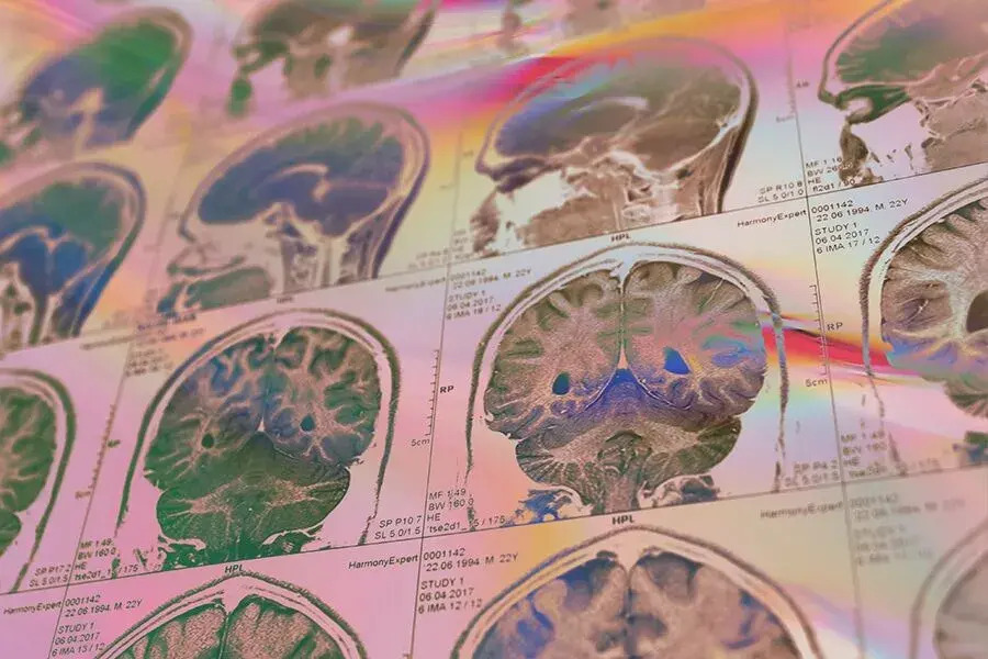 Can Psychedelics Jumpstart Consciousness?